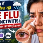 Monsoon Eye Flu (Conjunctivitis): लक्षण, बचाव, घरेलू देखभाल और कब डॉक्टर को दिखाएं