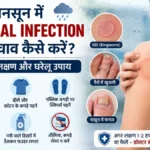 मानसून में Fungal Infection से बचाव: दाद, खुजली के लक्षण और इलाज