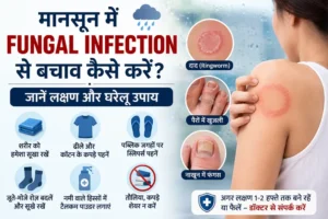 मानसून में Fungal Infection, दाद और खुजली से बचाव
