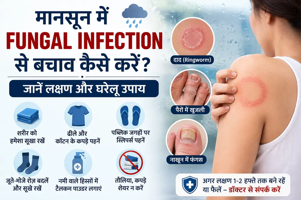 मानसून में Fungal Infection, दाद और खुजली से बचाव